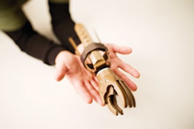 A prosthetic hand built by a Helping Hands group